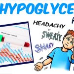 What Is Hypoglycemia How To Control It